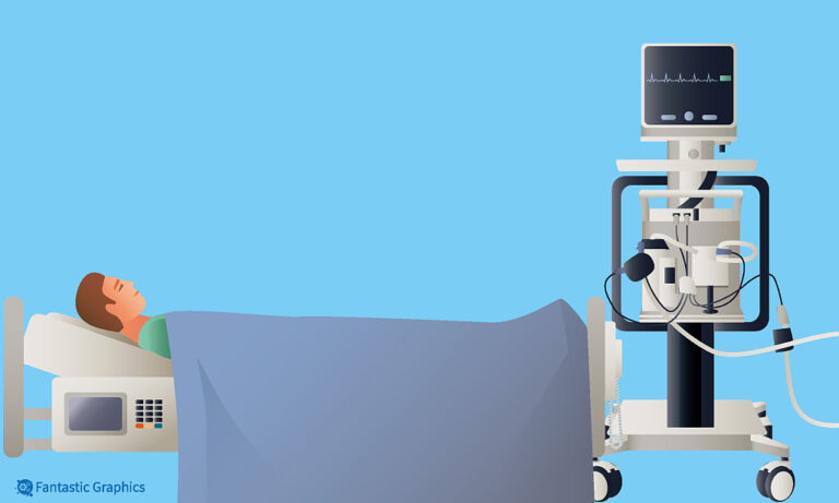 Chinesische ECMO-Produkte für den Markt zugelassen